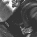 Второй конец патрубка отсоедините от штуцера.